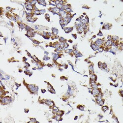 Invitrogen SUCLG2 Polyclonal Antibody 100 &mu;L; Unconjugated:Antibodies,