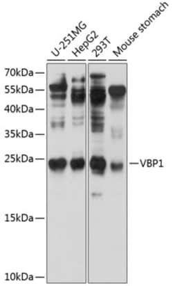 Invitrogen VBP1 Polyclonal Antibody 100 &mu;L; Unconjugated:Antibodies,