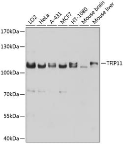 Invitrogen TFIP11 Polyclonal Antibody 100 &mu;L; Unconjugated:Antibodies,