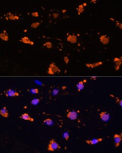 Invitrogen SIRP alpha Polyclonal Antibody 100 &mu;L; Unconjugated:Antibodies,