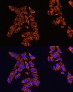Invitrogen SIRP alpha Polyclonal Antibody 100 &mu;L; Unconjugated:Antibodies,