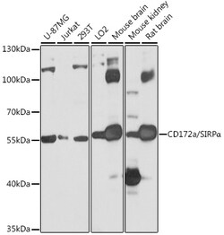 Invitrogen SIRP alpha Polyclonal Antibody 100 &mu;L; Unconjugated:Antibodies,