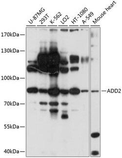 Invitrogen beta Adducin Polyclonal Antibody 100 &mu;L; Unconjugated:Antibodies,