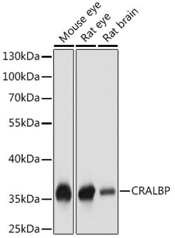 CRALBP Polyclonal Antibody:Antibodies, Polyclonal