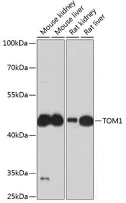 Invitrogen TOM1 Polyclonal Antibody 100 &mu;L; Unconjugated:Antibodies,