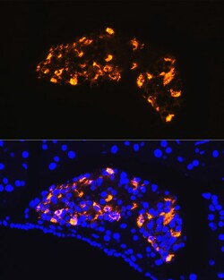 Invitrogen Somatostatin Polyclonal Antibody 100 &mu;L; Unconjugated:Antibodies,