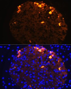 Invitrogen Somatostatin Polyclonal Antibody 100 &mu;L; Unconjugated:Antibodies,