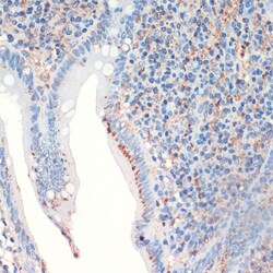 Invitrogen Somatostatin Polyclonal Antibody 100 &mu;L; Unconjugated:Antibodies,