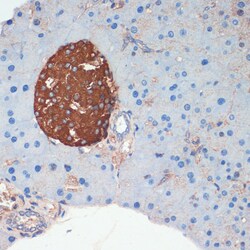 Invitrogen Somatostatin Polyclonal Antibody 100 &mu;L; Unconjugated:Antibodies,