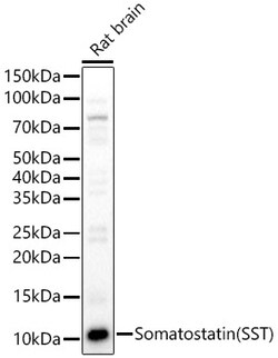 Invitrogen Somatostatin Polyclonal Antibody 100 &mu;L; Unconjugated:Antibodies,
