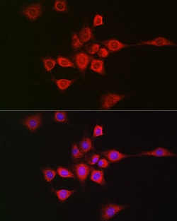 Invitrogen METTL4 Polyclonal Antibody 100 &mu;L; Unconjugated:Antibodies,