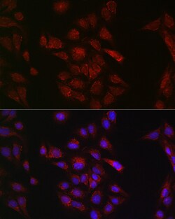 Invitrogen METTL4 Polyclonal Antibody 100 &mu;L; Unconjugated:Antibodies,