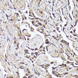 Invitrogen METTL4 Polyclonal Antibody 100 &mu;L; Unconjugated:Antibodies,