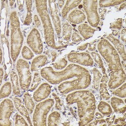 Invitrogen METTL4 Polyclonal Antibody 100 &mu;L; Unconjugated:Antibodies,