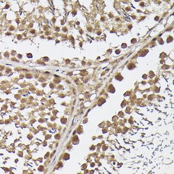 Invitrogen METTL4 Polyclonal Antibody 100 &mu;L; Unconjugated:Antibodies,