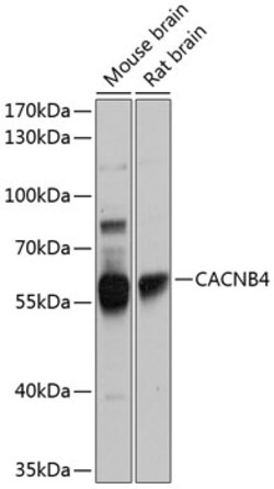 Invitrogen Calcium Channel beta-4 Polyclonal Antibody 100 &mu;L; Unconjugated:Antibodies,
