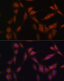 Invitrogen PFKFB2 Polyclonal Antibody 100 &mu;L; Unconjugated:Antibodies,