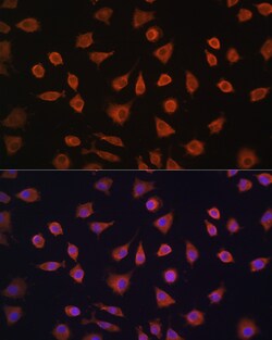 Invitrogen PFKFB2 Polyclonal Antibody 100 &mu;L; Unconjugated:Antibodies,