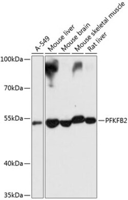 Invitrogen PFKFB2 Polyclonal Antibody 100 &mu;L; Unconjugated:Antibodies,