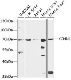 KCNN1 Polyclonal Antibody:Antibodies, Polyclonal