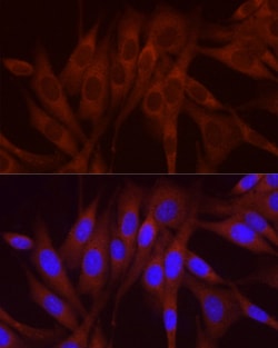Invitrogen NUMB Polyclonal Antibody 100 &mu;L; Unconjugated:Antibodies,