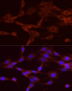 Invitrogen NUMB Polyclonal Antibody 100 &mu;L; Unconjugated:Antibodies,