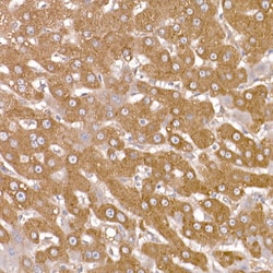 Invitrogen NUMB Polyclonal Antibody 100 &mu;L; Unconjugated:Antibodies,