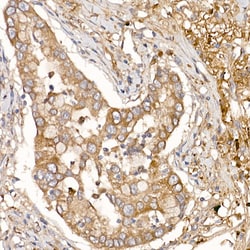 Invitrogen NUMB Polyclonal Antibody 100 &mu;L; Unconjugated:Antibodies,