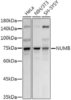 Invitrogen NUMB Polyclonal Antibody 100 &mu;L; Unconjugated:Antibodies,