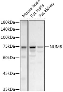 Invitrogen NUMB Polyclonal Antibody 100 &mu;L; Unconjugated:Antibodies,