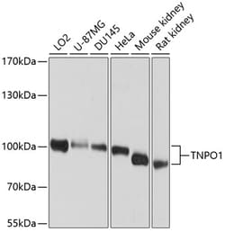 Invitrogen TNPO1 Polyclonal Antibody 100 &mu;L | Buy Online | Invitrogen&trade; | Fisher Scientific