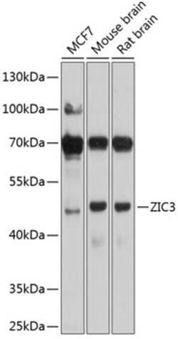 Invitrogen ZIC3 Polyclonal Antibody 100 &mu;L; Unconjugated:Antibodies,