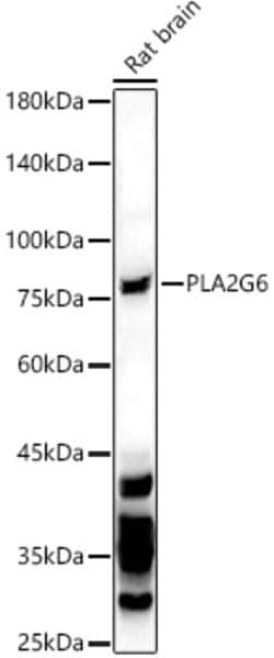 Invitrogen PLA2G6 Polyclonal Antibody 100 &mu;L; Unconjugated:Antibodies,