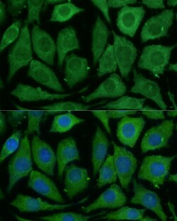 Invitrogen SARDH Polyclonal Antibody 100 &mu;L; Unconjugated:Antibodies,