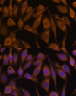 Invitrogen Ubiquilin 2 Polyclonal Antibody 100 &mu;L | Buy Online | Invitrogen&trade; | Fisher Scientific