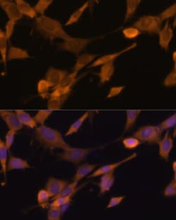 Invitrogen Ubiquilin 2 Polyclonal Antibody 100 &mu;L | Buy Online | Invitrogen&trade; | Fisher Scientific