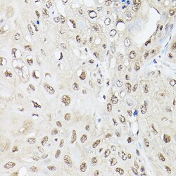 Invitrogen Ubiquilin 2 Polyclonal Antibody 100 &mu;L | Buy Online | Invitrogen&trade; | Fisher Scientific