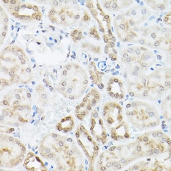 Invitrogen Ubiquilin 2 Polyclonal Antibody 100 &mu;L | Buy Online | Invitrogen&trade; | Fisher Scientific
