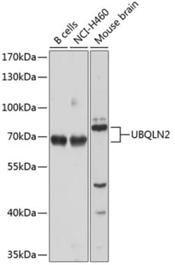 Invitrogen Ubiquilin 2 Polyclonal Antibody 100 &mu;L | Buy Online | Invitrogen&trade; | Fisher Scientific