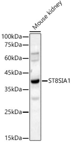 Invitrogen ST8SIA1 Polyclonal Antibody 100 &mu;L; Unconjugated:Antibodies,