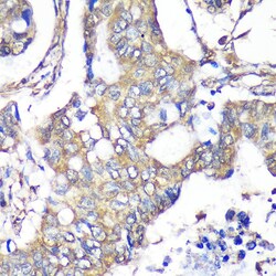 Invitrogen TXNDC9 Polyclonal Antibody 100 μL; Unconjugated:Antibodies,