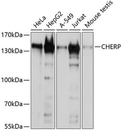 Invitrogen CHERP Polyclonal Antibody 100 &mu;L; Unconjugated:Antibodies,