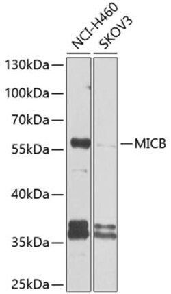 Invitrogen MICB Polyclonal Antibody 100 &mu;L; Unconjugated:Antibodies,