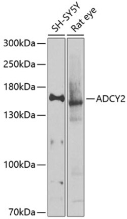 Invitrogen ADCY2 Polyclonal Antibody 100 &mu;L; Unconjugated:Antibodies,