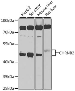 Invitrogen CHRNB2 Polyclonal Antibody 100 &mu;L; Unconjugated:Antibodies,