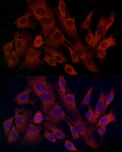 Invitrogen TIMM8A Polyclonal Antibody 100 &mu;L; Unconjugated:Antibodies,