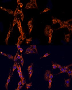 Invitrogen EPS15 Polyclonal Antibody 100 &mu;L; Unconjugated:Antibodies,