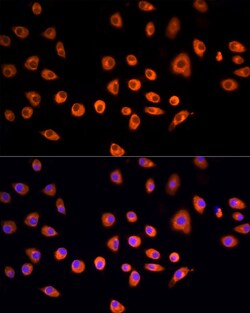Invitrogen EPS15 Polyclonal Antibody 100 &mu;L; Unconjugated:Antibodies,