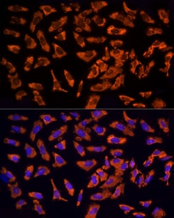 Invitrogen EPS15 Polyclonal Antibody 100 &mu;L; Unconjugated:Antibodies,