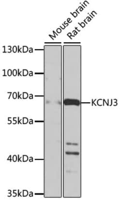 Invitrogen Kir3.1 (KCNJ3) Polyclonal Antibody 100 &mu;L; Unconjugated:Antibodies,